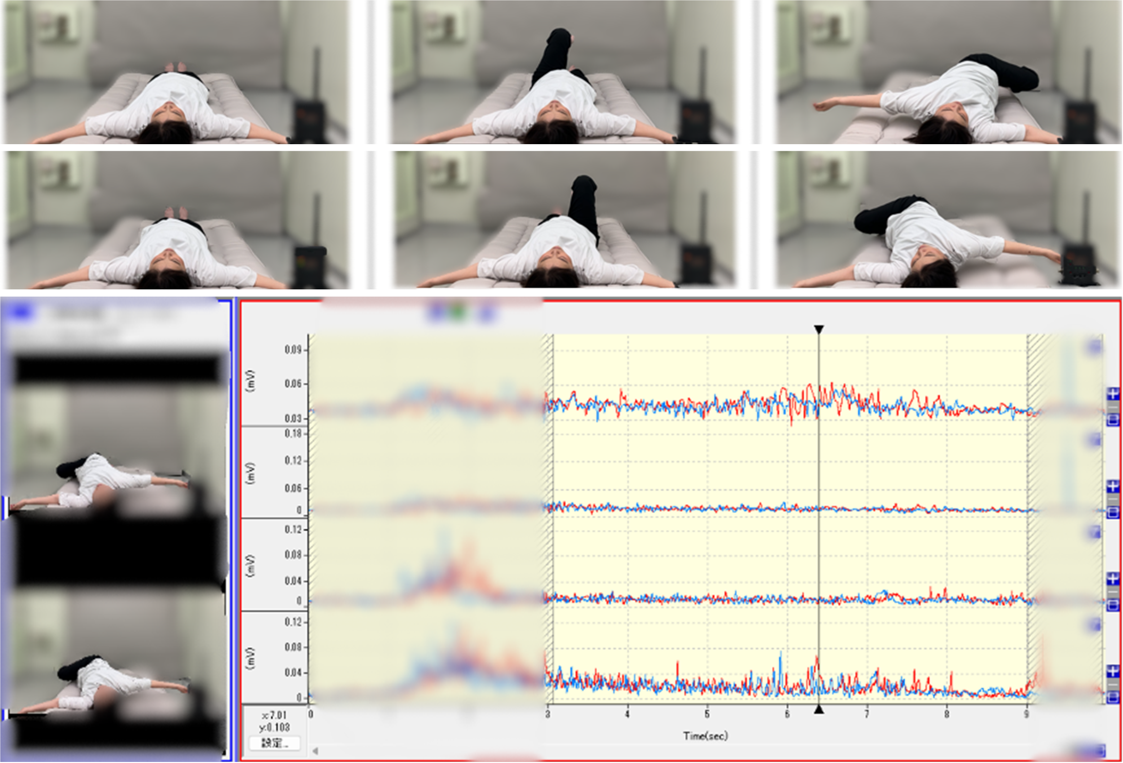 筋電図3